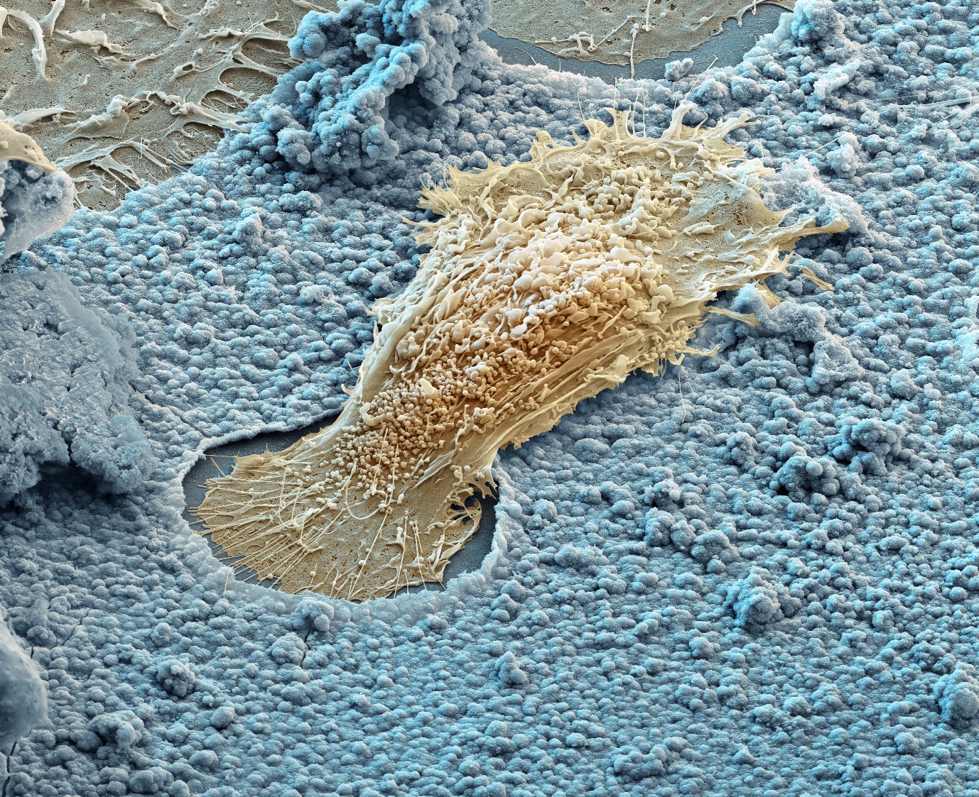 Figure 1 in<i> Cell-to-Cell Communication: Cell Atlas – Visual Biology in Oral Medicine</i>, page 146: Scanning electron microscopy of an osteoclast in its resorption lacuna. (Courtesy of eye science.)